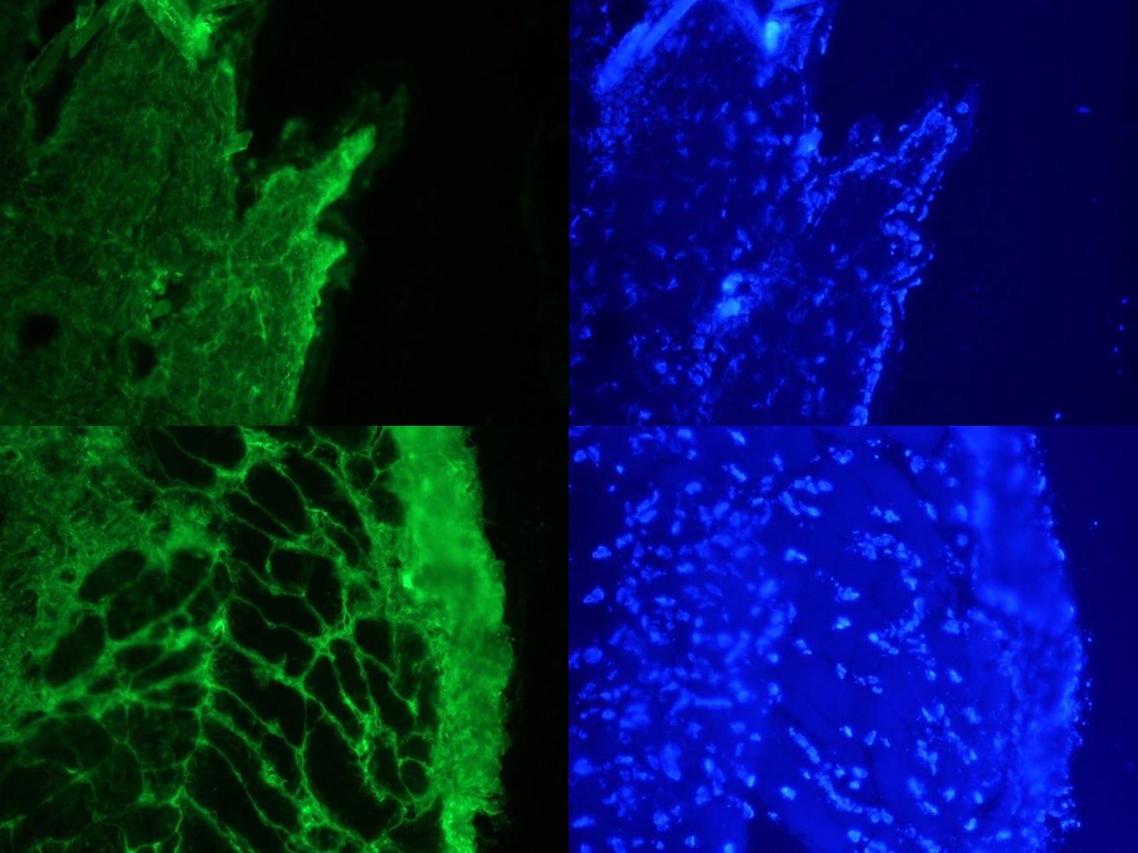 Figure 1. Images on the left: Specific indirect immunostaining of connective tissue in frozen sections of mouse skin with FI24951 (diluted 1:1000) Images on the right: Corresponding DAPI staining of nuclei in epidermis, muscle and connective tissue.